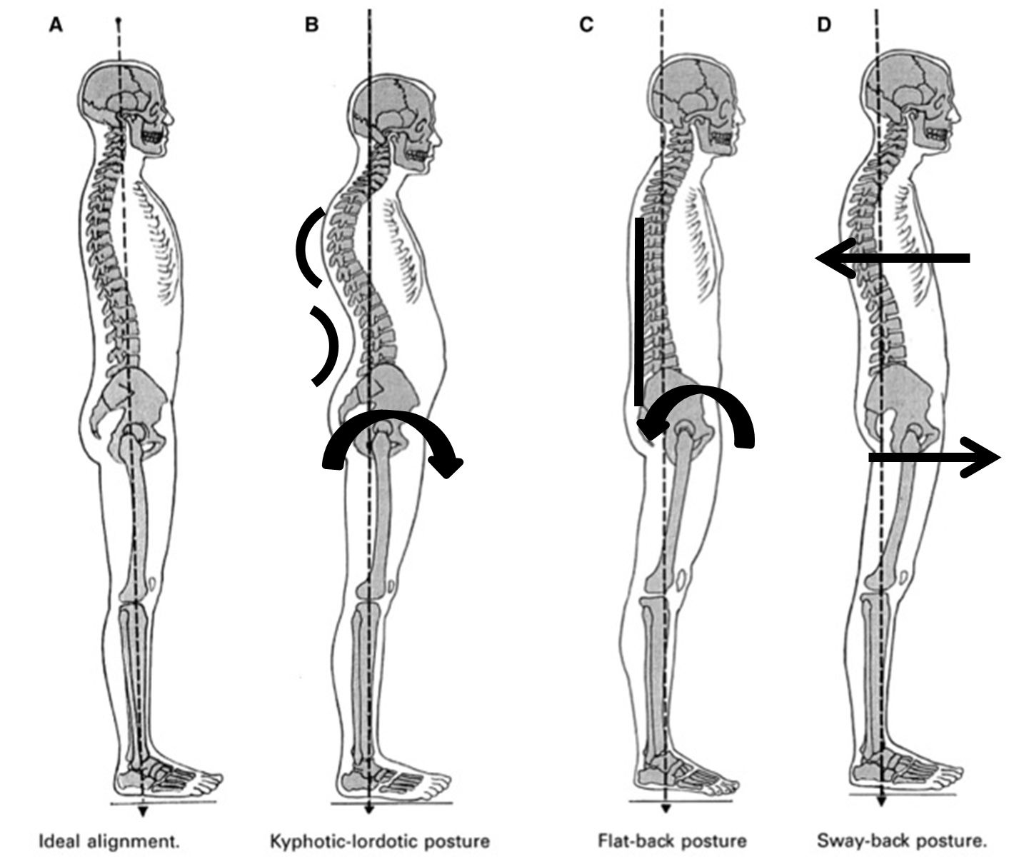 Lower Back Alignment for Maximizing spinal alignment with 16x24 lumbar support systems